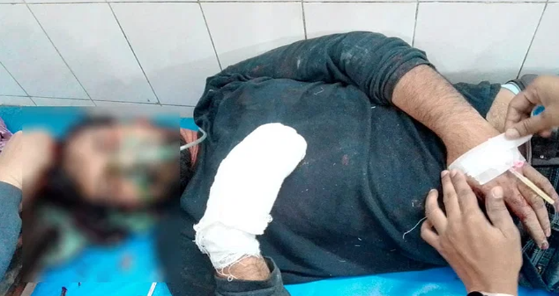 আসামি ধরতে গিয়ে হামলার শিকার হয়ে র‌্যাব সদস্যের তিন আঙুল বিচ্ছিন্ন