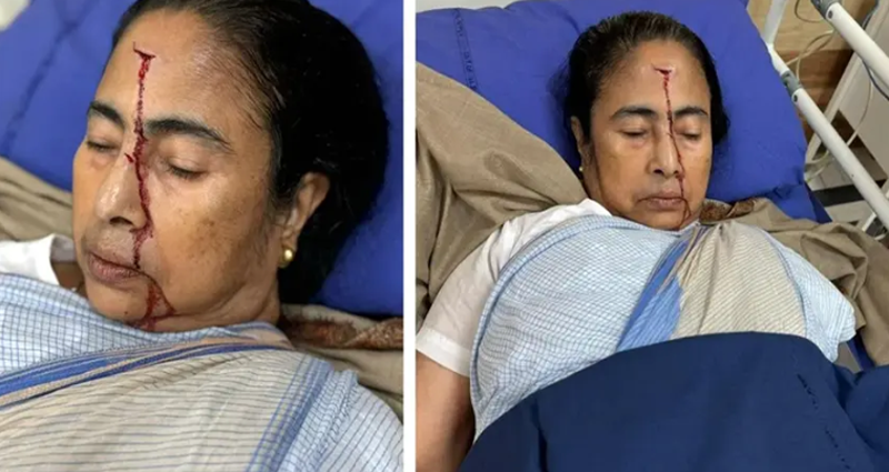 গুরুতর জখম মুখ্যমন্ত্রী মমতা বন্দ্যোপাধ্যায়, কপাল ফেটে গড়াল রক্ত