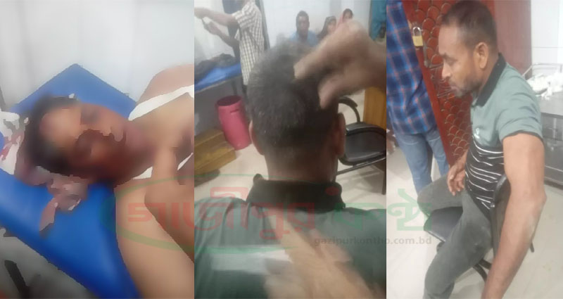 কাপাসিয়ায় আসামির হামলায় এসআই ও আনসার আহত