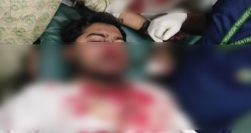আইনশৃঙ্খলাবাহিনীর লাঠিচার্জ, রক্তাক্ত নুর, আহত ৫০