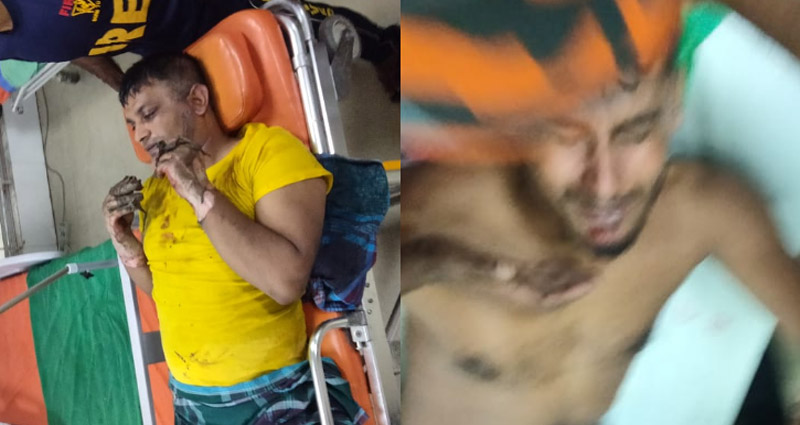 টঙ্গীতে কেমিক্যাল গোডাউনে আগুন, ফায়ার সার্ভিসের চারজন দগ্ধ